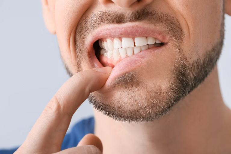 denti e gengive sensibili